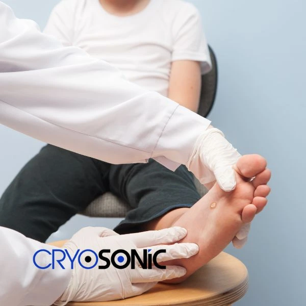 Are you looking for fast effective wart removal Contact us today Coalville